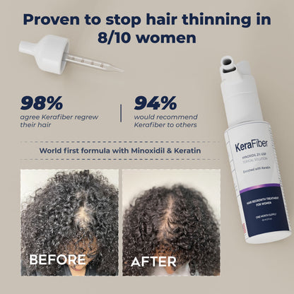 Hair Regrowth and Strengthening Treatment - KeraFiber UK